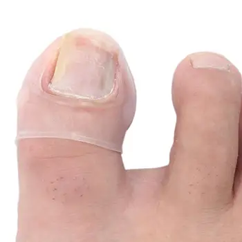 

2pcs/Box Invisible Anti Paronychia Prdicure Soft Ingrown Toe Nail Correction Treatment Orthotics Sticker Patch Foot Care Tools