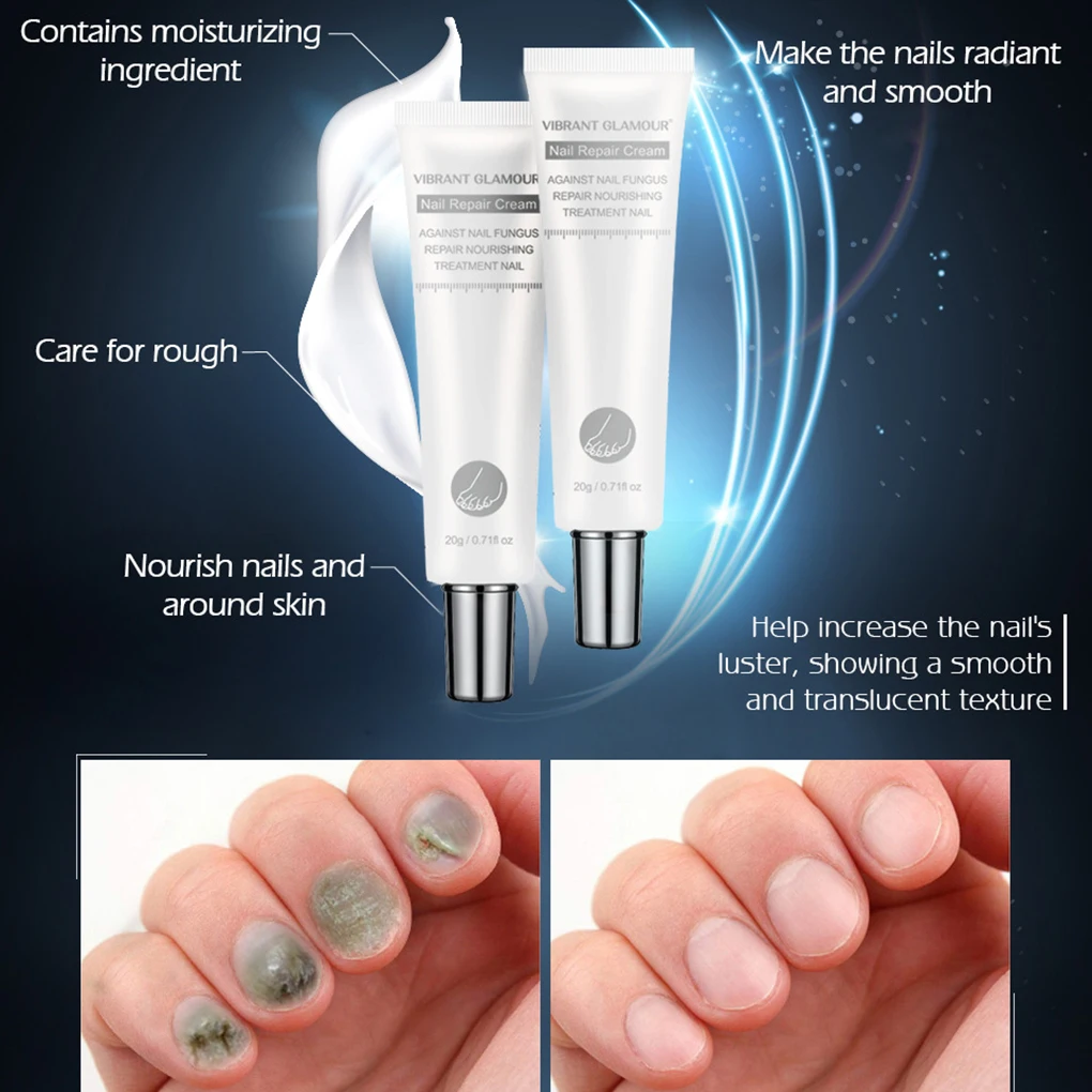 Special Offer for  VIBRANT GLAMOUR Nail Care Nail Repair Cream Nail Fungus Treatment Onychomycosis Removal Anti Fungus