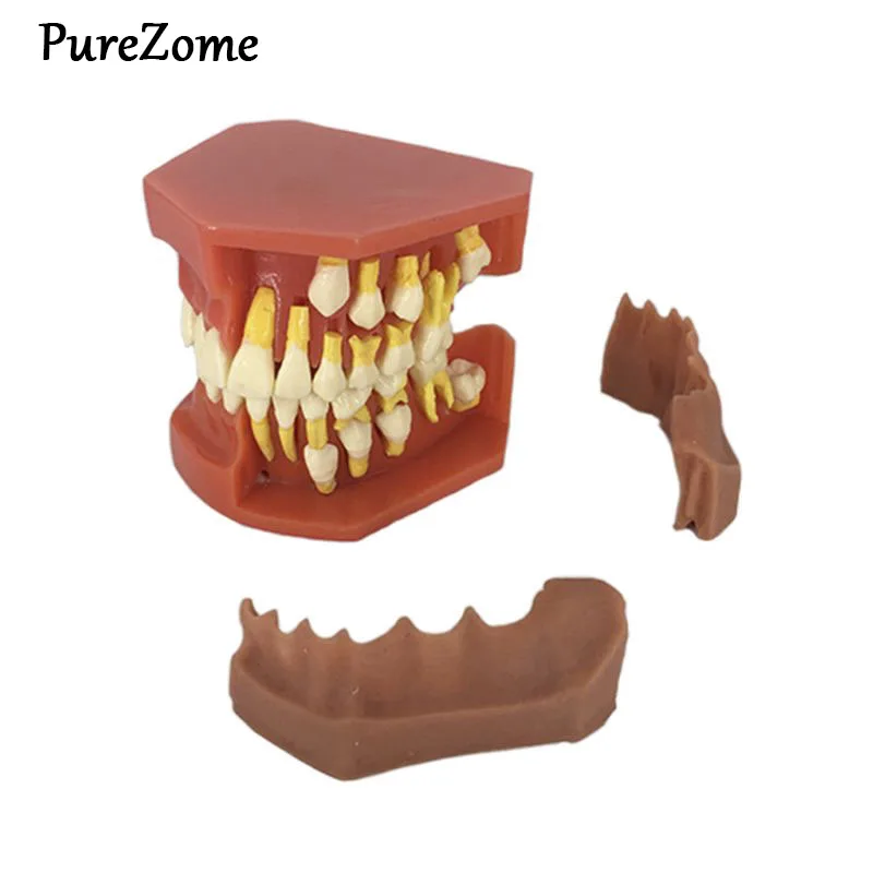 

Dental Children Removable Deciduous Teeth Model Permanent Tooth Alternative Display Studying Teaching Tool