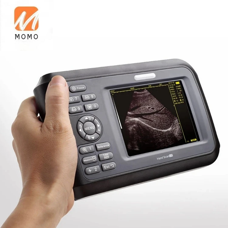 Рисунок 3 - Портативный Ветеринарный ультразвуковой