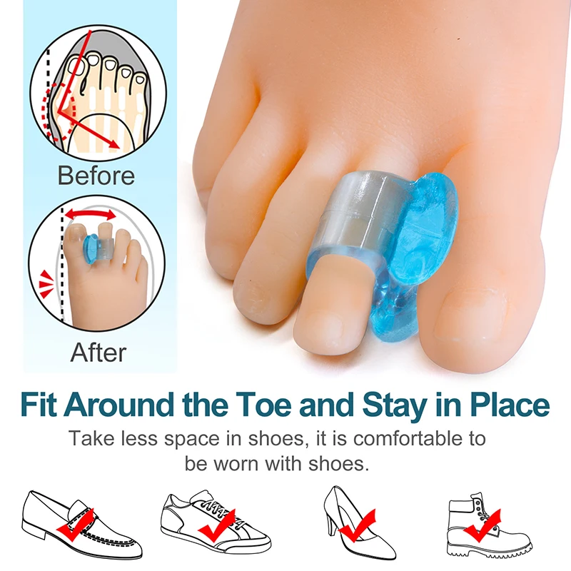 10pcs=5pairs Blue Silicone Gel Toe Separator Hallux Valgus Thumb Corrector Soft Bunion Spacers Foot Care Tool Pedicure D2853