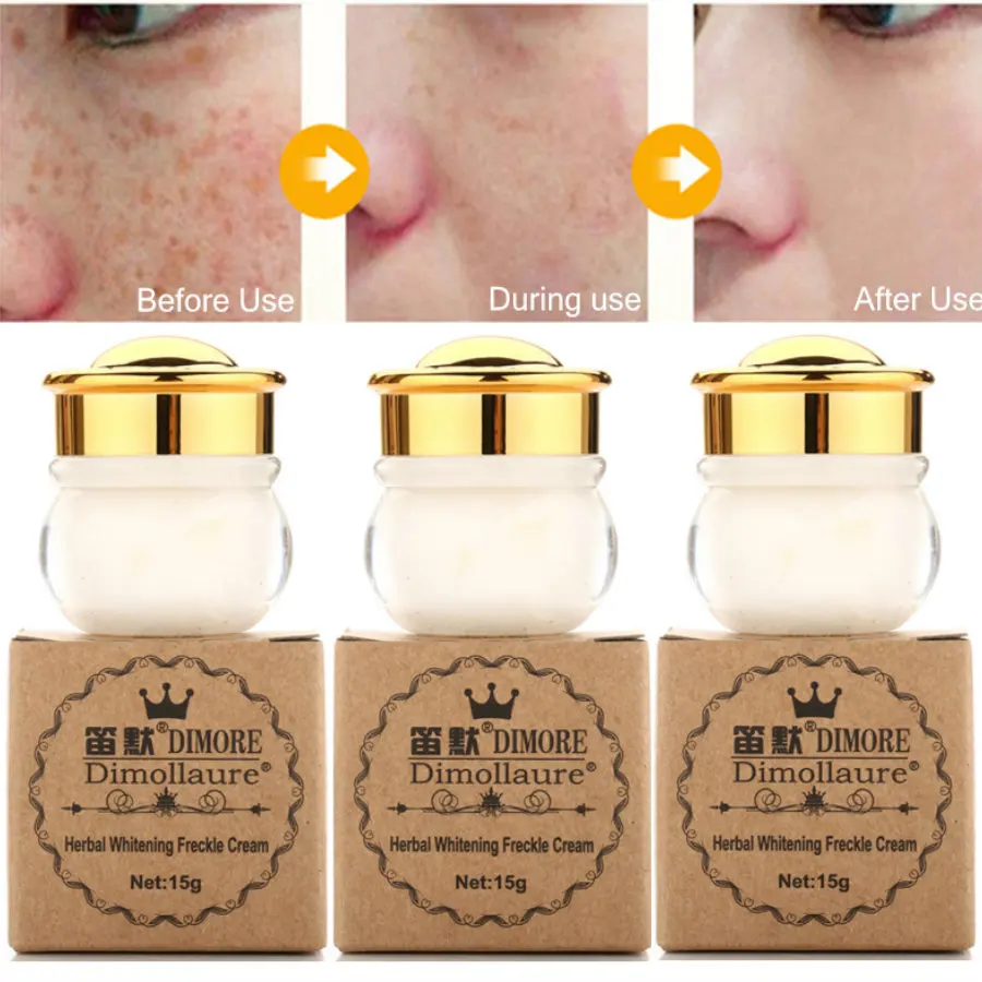 3 шт. Dimollaure крем для отбеливания веснушек Remova melasma шрамы от акне пигмент меланин коричневые пятна солнце sopts крем с ретинолом крем для лица