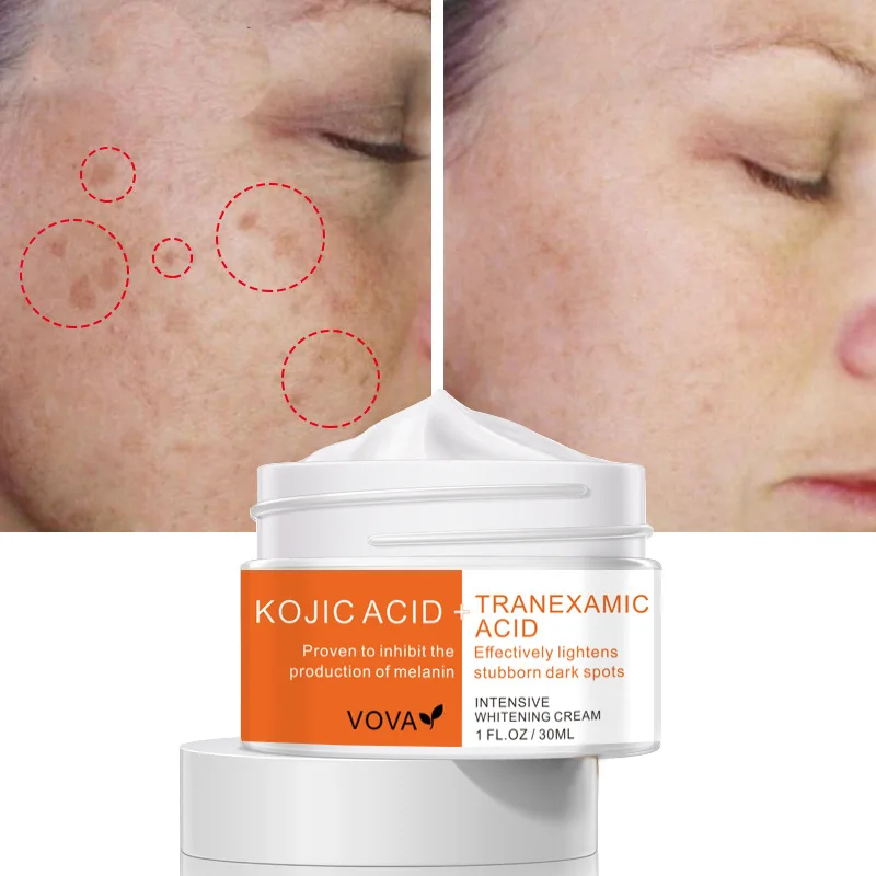 Kojic Acid Face Whitening Cream Tranexamic Acid Cream Inhibit The