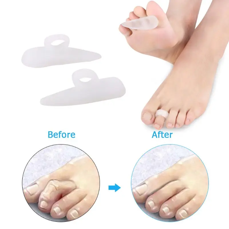 2 Pcs Hammer Toe Treatment Tools Soft Gel Splints Feet Toes Correctors Separator 2 Pcs Hammer Toe Treatment Tools Soft Gel Splints Feet Toes Correctors Separator