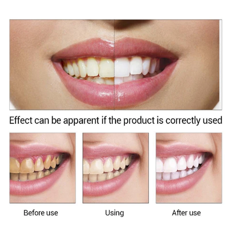 Teeth Whitening Serum Powder Oral Hygiene Cleaning Serum Removes Plaque Stains Tooth Bleaching Tools Drop Free TSLM1 teeth cleaner,teeth whitening gel,teeth whitening powder,teeth whitening toothpaste,teeth whitening kit,teeth whitening strips