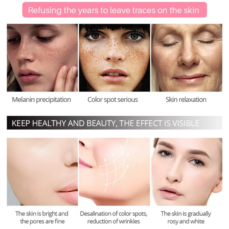 Strong effect whitening cream 50g Remove Freckle melasma Acne Spots pigment Melanin face care cream FM82