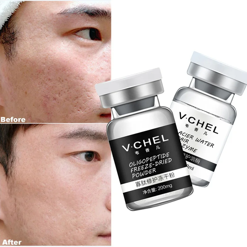 

WXE Lyophilized Epidermal Growth Factor Powder Serum Acne Pimples Scars Wrinkles Treatment Skin Care