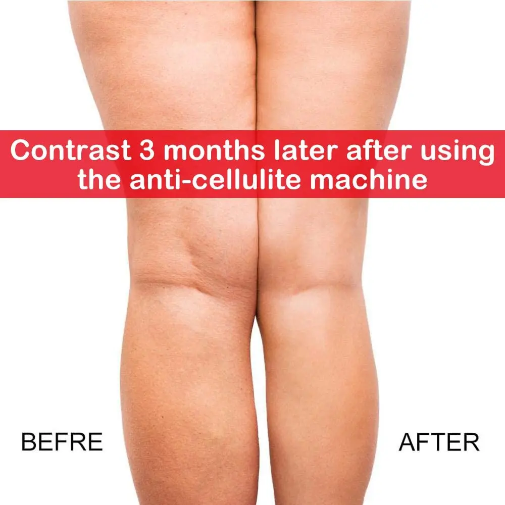 61RAIVURi5L._AC_SL1000_