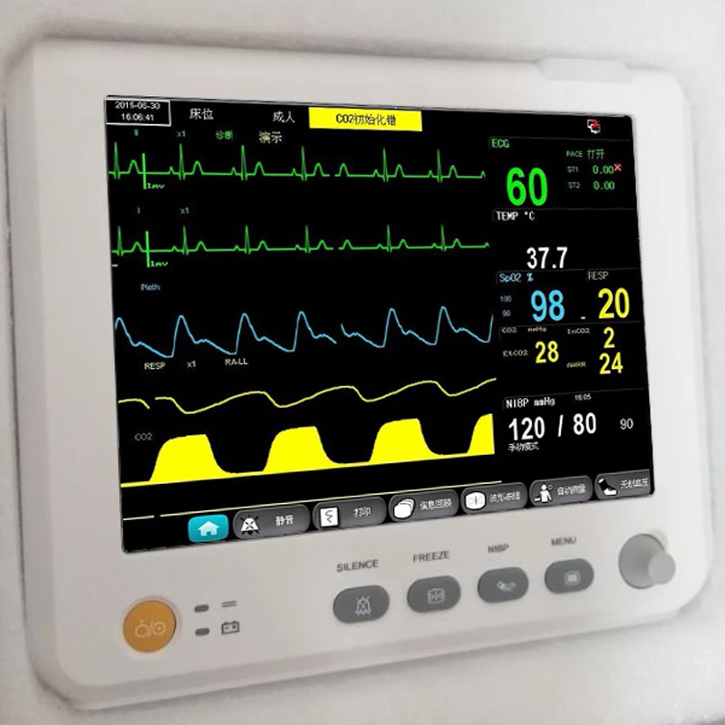 Медицинское оборудование 7 дюймов 6 параметров монитор пациента NIBP, Spo2, PR, ECG, RESP, TEMP мульти-параметры монитор пациента