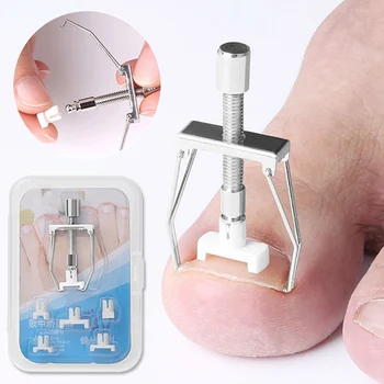 

1Pc Ingrown Toenails Correction Pedicure Foot Toe Nail Care Tools File Elastic Patch Straightening Clip Brace Corrector Fixer