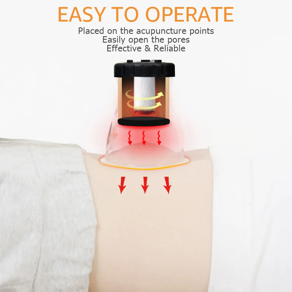 Chinese Medicine Moxibustion Acupuncture Points Cupping Burning Moxa Chinese Cupping Heating Therapy Anti-broken Vacuum Can