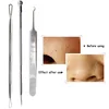 BlackHead Remover Tool Black Head Acne Blemish Pimple Extractor Acne Needles Tweezer Pore Cleaner Face Cleansing Tools Skin Care ► Photo 3/6