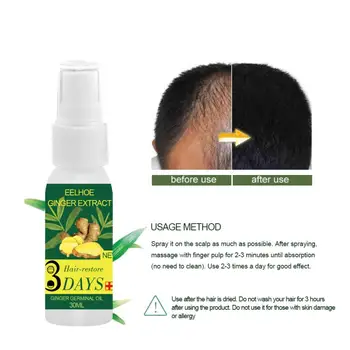 

30ML Ginger Hair Growth Spray Anti Hair Loss Serum Essence for Fast Hair Growth Treatment Oil Hair Tonic Conditioner Hair Care