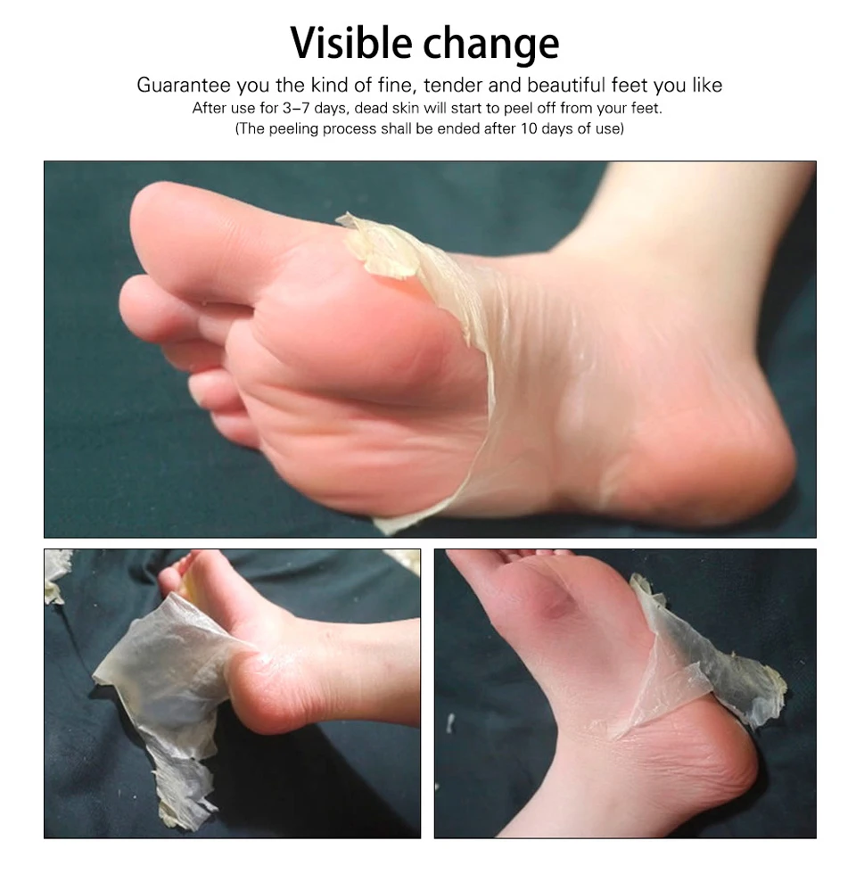 H55556e1292394246a009ae0a84bbb78aM HEMEIEL Cucumber Hydrating Foot Peel Masks For Skin Removal Calluses Exfoliating Heel Socks Whitening Tender Feet 1Pair=2PCs