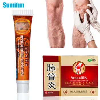 

Sumifun Varicose Veins Treatment Ointment& 6Pcs Medical Plaster Analgesic Cream Vasculitis Phlebitis Spider Leg Angiitis Removal