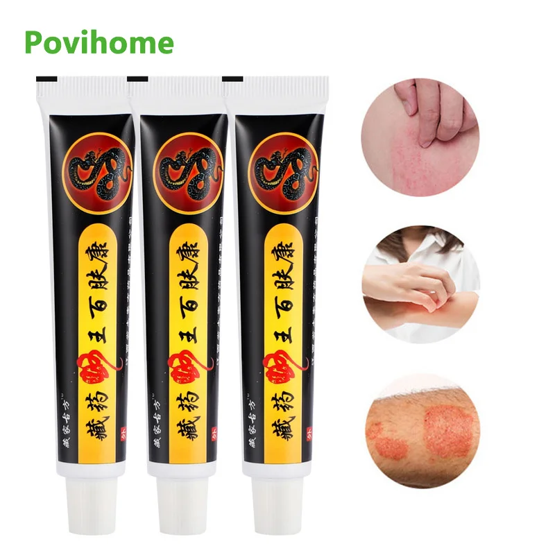 

1/3pcs New Snake Oil Extract Ointment Skin Itching Eczema Psoriasis Itching Antibacterial Cream Antipruritic Skin Care Plaster