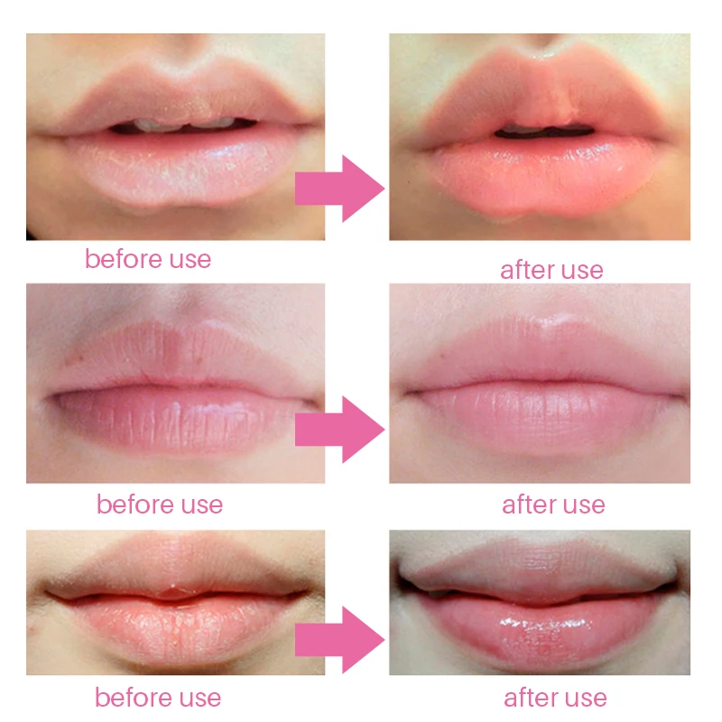 Winter Protect Collagen Lips Care Smooth Lip Moisturizing Renewal Remove Cuticle Exfoliating Beauty Care Golden Lip Mask 10Pcs images - 6