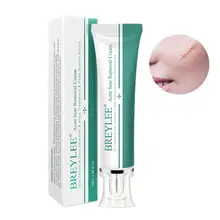 Новинка! Удаление Шрама от акне крем Кожа Восстанавливающий крем для лица акне пятна акне лечение отбеливание чёрных точек крем противошрамный растяжки