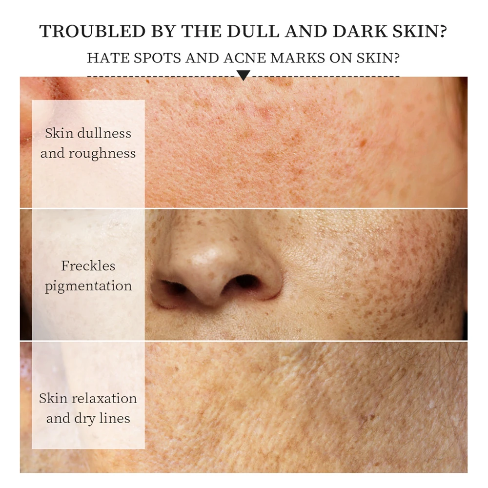 VIBRANT GLAMOUR Vitamin C Face Mask Whitening Moisturizing Freckle Firming Mask Shrink Pores Improve Dull Rough 5