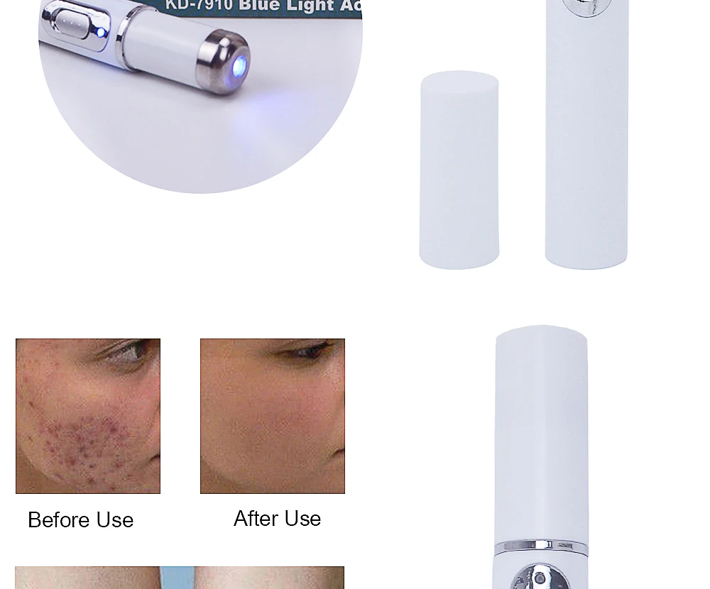 Licheng Acne Laser Pen Portable Wrinkle Removal Machine Durable Soft Scar Remover Device Blue Light Therapy Pen Massage Relax