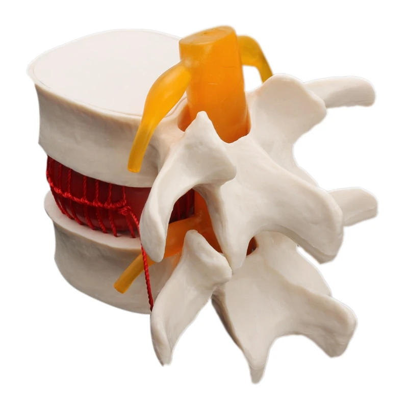 

Human Anatomy Skeleton Spine Lumbar Disc Herniation Teaching Model Brain Skull Traumatic School Supplies Instrume