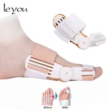 Корректор большого пальца стопы, вальгусная деформация, ортопедические скобы для пальца ноги, сепаратор для шипов, выпрямитель, корректор, инструмент для ухода за ногами