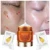 BREYLEE Vitamin C Face Cream Serum VC 20% Fade Веснушки Удалить Темные Пятна Кремы Для Лица Маска Отбеливающий Увлажняющий Дневной Крем