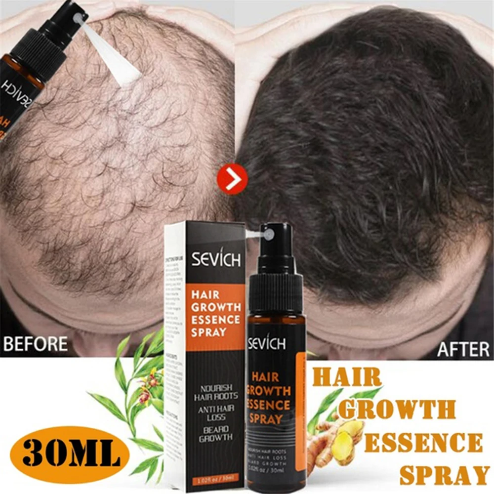 Восстанавливающий спрей против выпадения волос, спрей для роста волос, эфирное масло, жидкость для мужчин и женщин, продукты для Восстановления сухих волос, уход за волосами