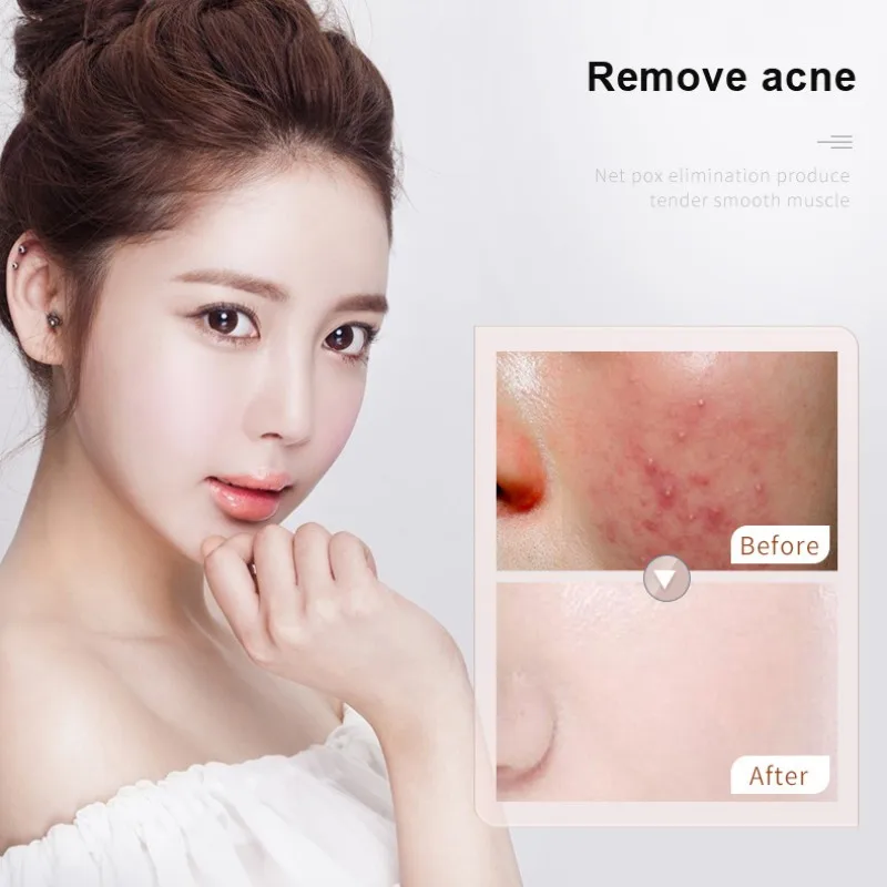 15 мл Niacinamide Essence сужает поры Сыворотка для лица укрепляющая кожа восстанавливает поры против черных точек увлажняет кожу для ухода за лицом