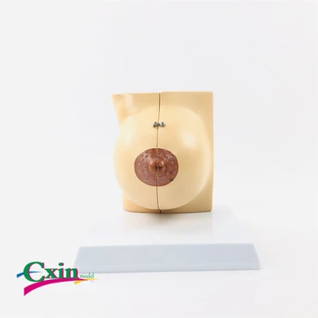 

Female quiescent female breast model Breast anatomy model gynecological demonstration medicine teaching