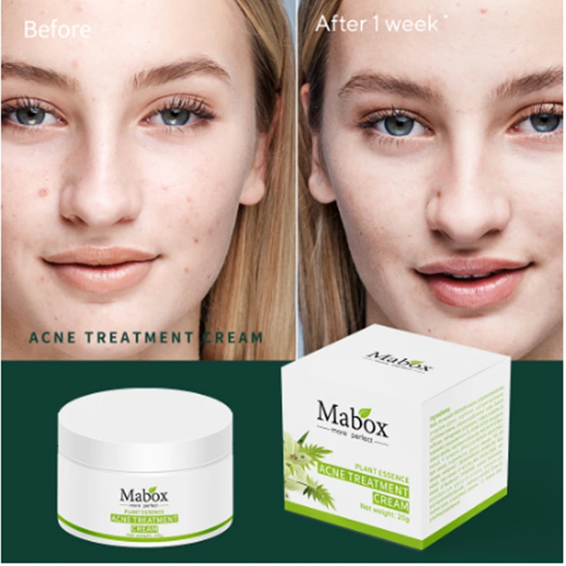 MABOX, 30 г, лечение акне, удаляет угрей, крем против акне, контроль за маслом, сужает поры, удаляет рубцы после акне уход за лицом; отбеливание