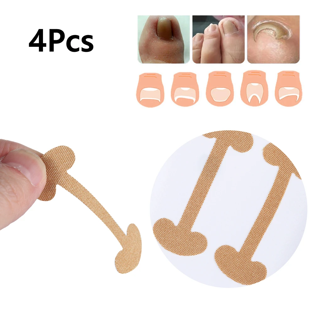 4 шт. профессиональные кусачки для удаления вросшего ноготя корректор ногтей