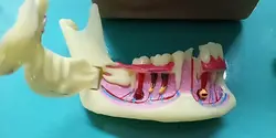 Dental Endodontic Treatment Model Anatomy of gums Dental Study Teach Teeth Model