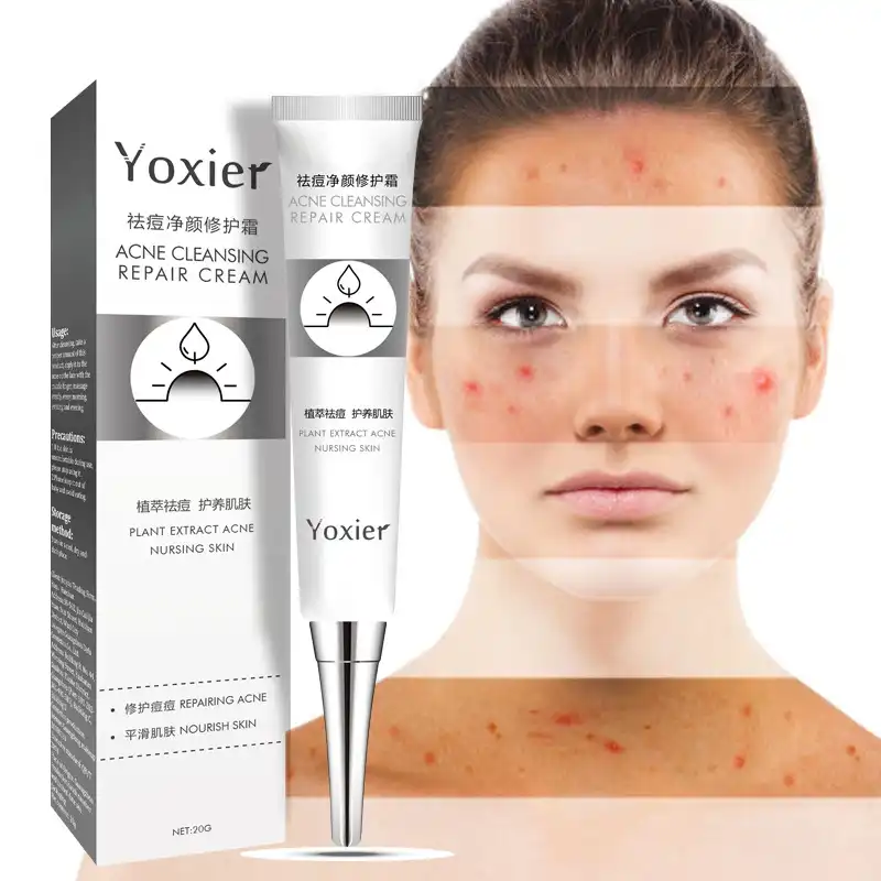 pimple remove night cream