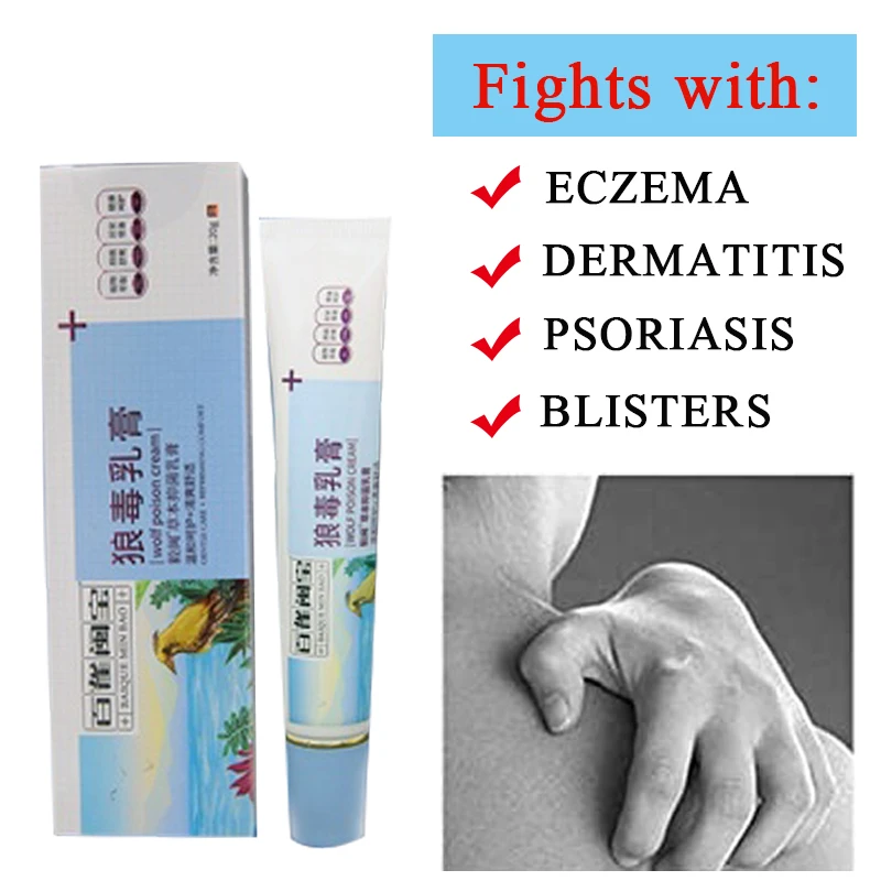 Eczema Cream Therapy Psoriasis Cream Itch Relief Dermatitis Rosacea Shingles Natural Formula Promote