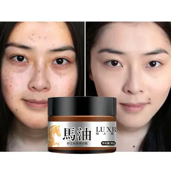 

Freckle Cream Dark Spot Corrector Remover Face Melasma Treatment Remove Hyperpigmentation Lightens Blemishes Skin Smoothing