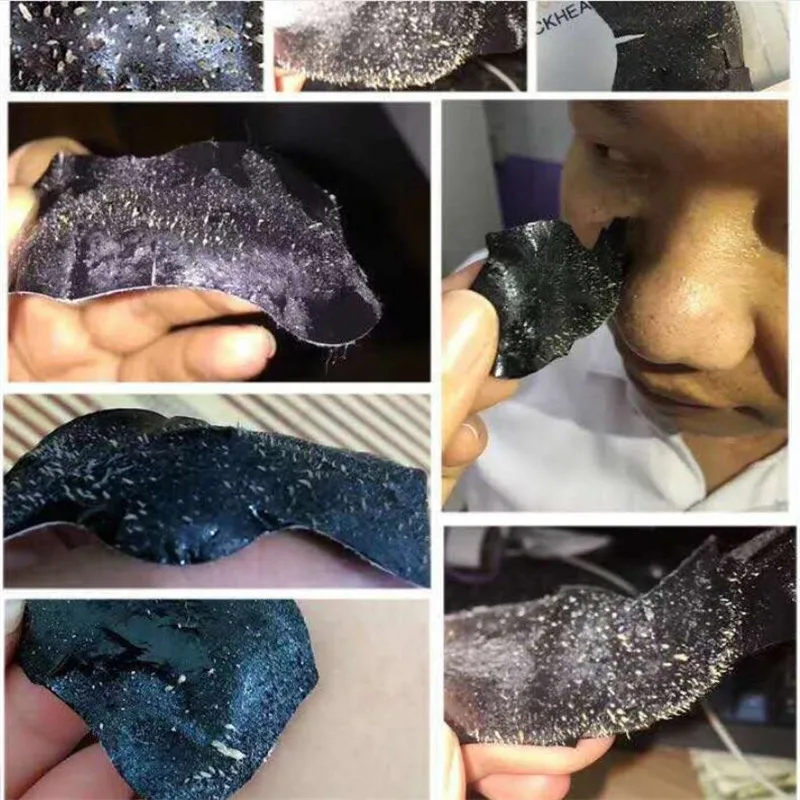 100Pcs Nose Blackheads Remove Mask Plaster Nose Strips Remove Blackheads Pores Black Dot Remover Acne Peel Mask Cleaning Patch