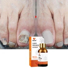 Уход восстановление ногтей гель удаление онихомикоза Сломанные ногтей Лечение ногтей продукт для роста ногтей maquiagem