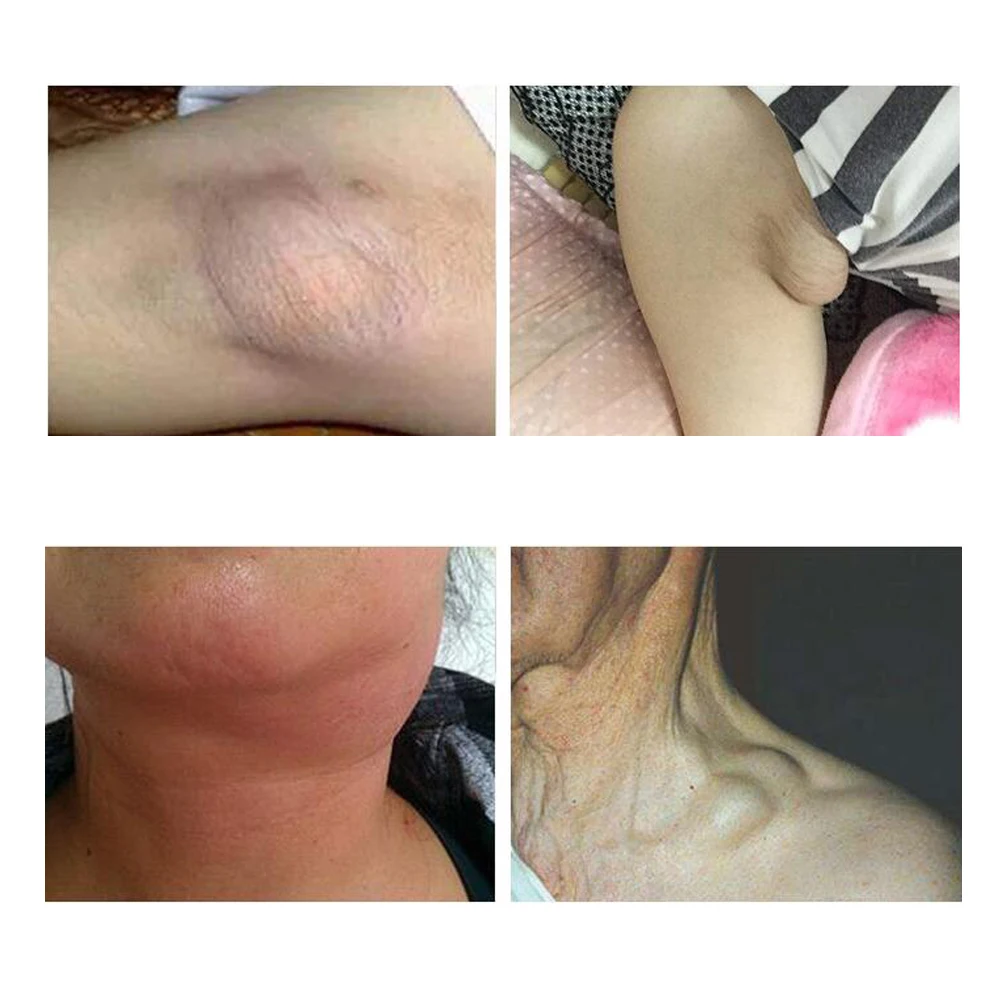 6 патчей органический лифодренажный пластырь с детоксикацией эффективный против