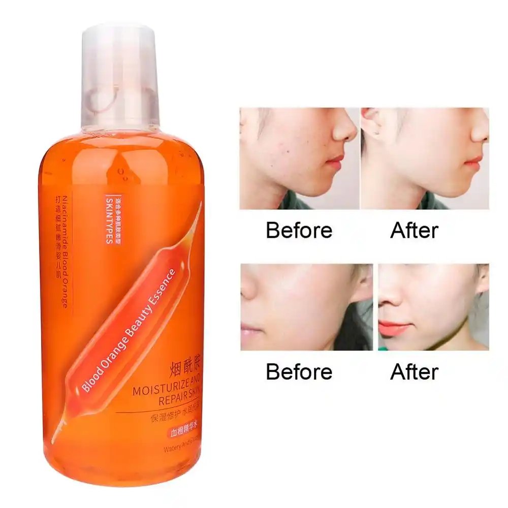 murad acne control clarifying cleanser