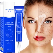 Effective Whitening Freckle Cream Remove Melasma Remove Pigment Dark Spots Treatment Hyaluronic Acid Moisturizing Firm Skin Care