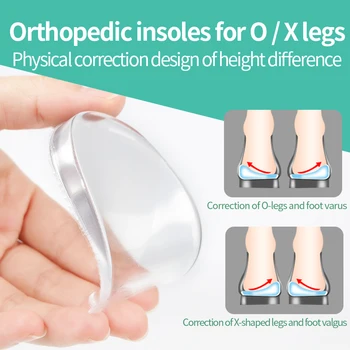 

Princepard 1 Pair Gel Orthopedic Insoles Arch Support Insole for O/X legs Correction Shoe Insert Health Feet Care Cushion Pads