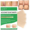 4 PcsEfficient Surgery Scar Removal Silicone Gel Sheet Therapy Patch for Acne Trauma Burn Scar Skin Repair Scar Treatment Tools
