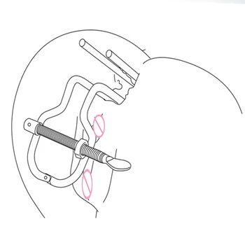 New ! Adjustable Vaginal Anus Clamp Anal Plug Sex Toys For Women/ Men /Couples Speculum Cleaning Enema Extreme Dilator Butt Plug 2