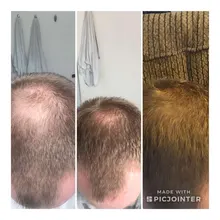 Cuidado del cabello para el crecimiento del cabello aceites esenciales esencia Original auténtico 100% pérdida de cabello líquido salud belleza suero denso para el crecimiento del cabello