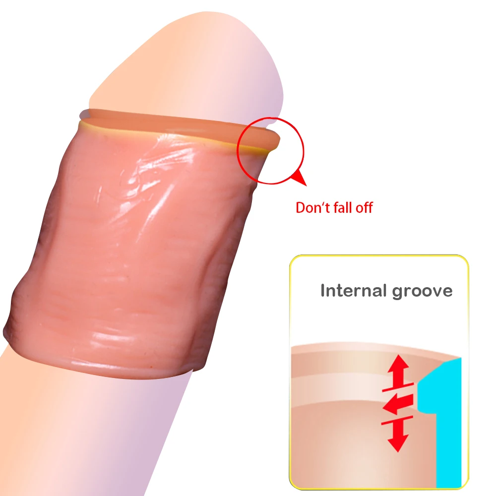5 шт./комплект кольцо на пенис для коррекции Foreskin|Кольца пениса| |