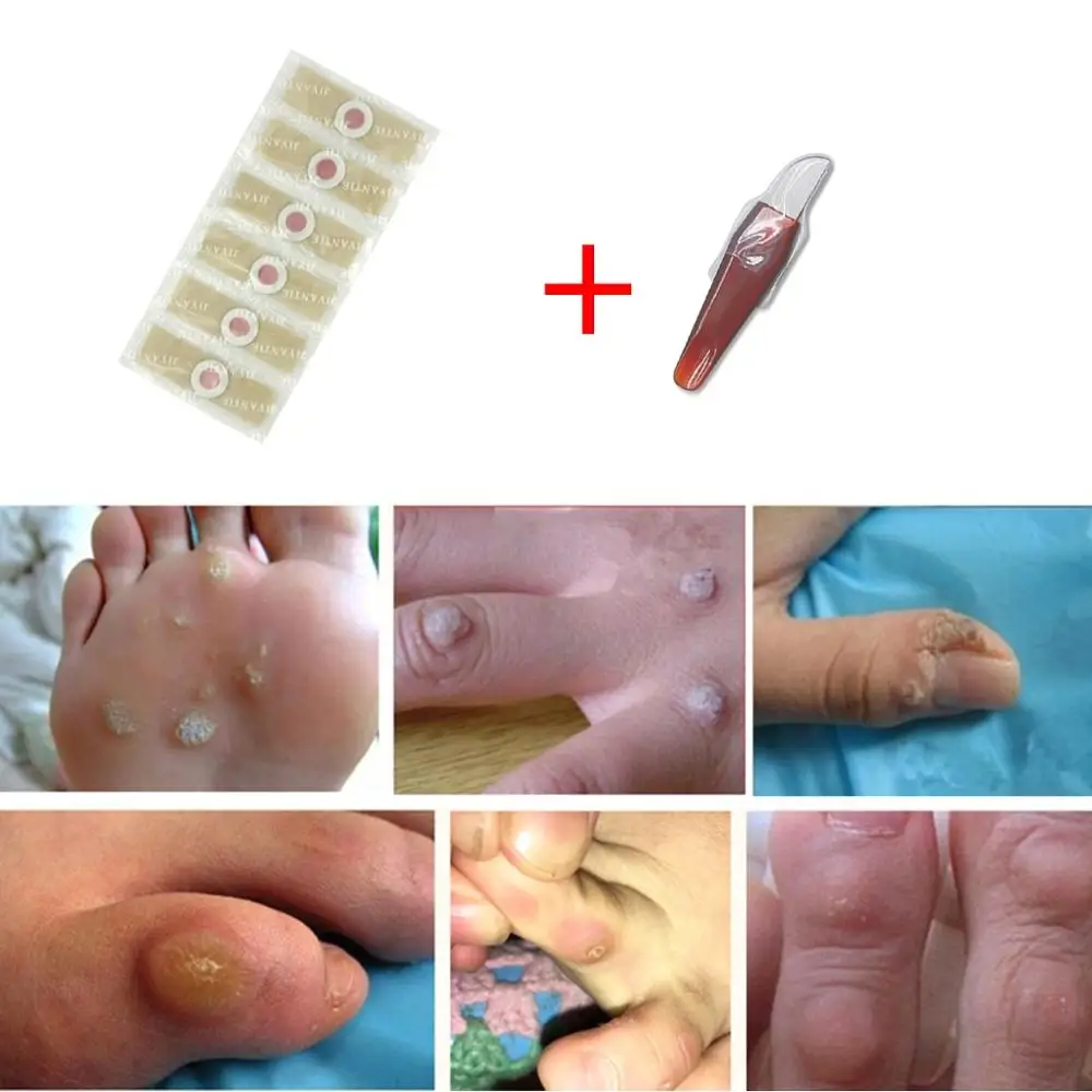 6pcs Wart Removal Patch Painlessly Remove Feet Callus Cutins Corn