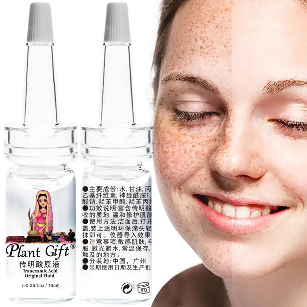 tranexamic acid topical acne