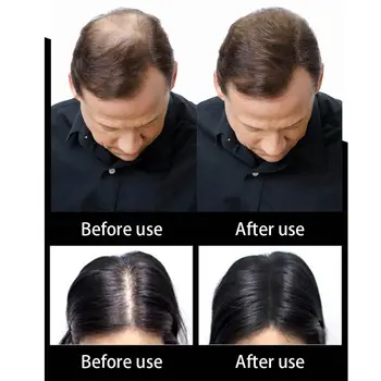 

Hot 25g Hair Fibers Spray Applicator Nozzle Pump Hairline Optimizer Kit Hair Loss Treatment CNT 66