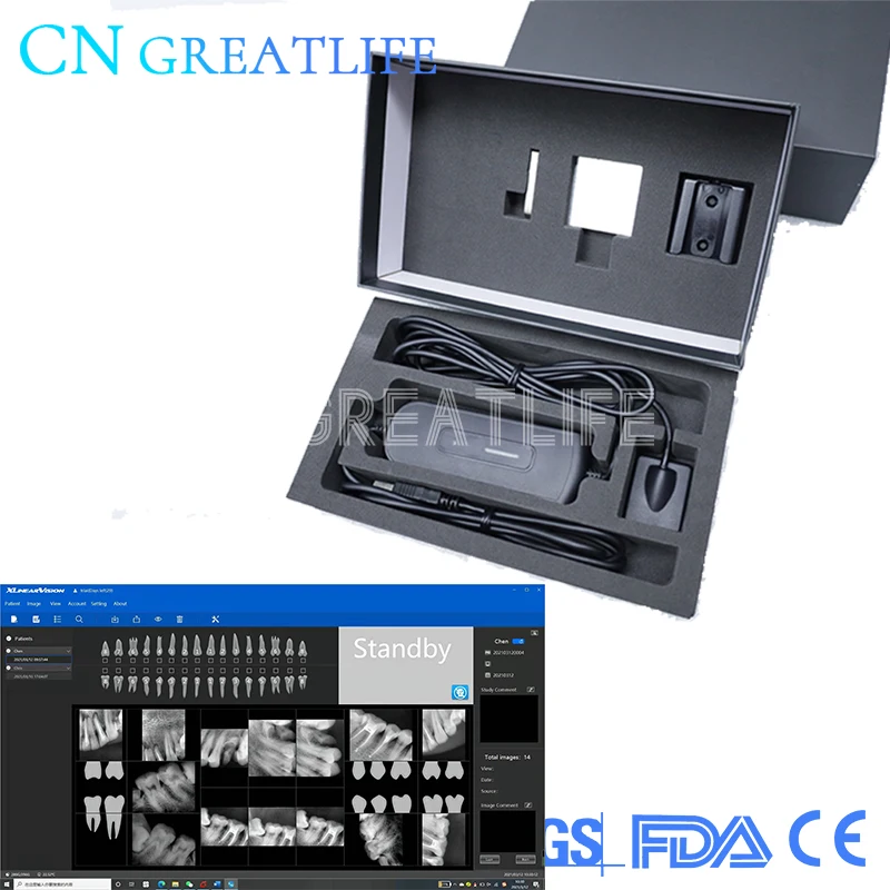 Дешевая Высококачественная система внутриоральной визуализации цифровой